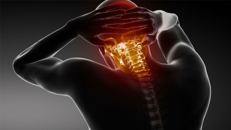 Schmerzen im Hinterkopf mit zervikaler Osteochondrose