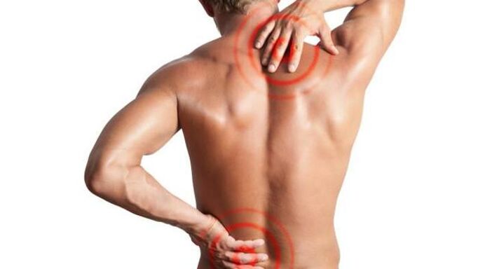 Schmerzen aufgrund von Osteochondrose